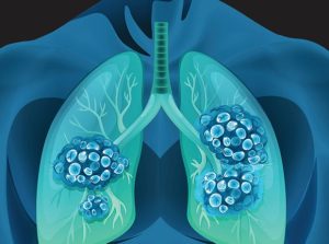 johnson-&-johnson-подайте-заявку-на-подкожную-дозировку-rybrevan-—-pharmatimes