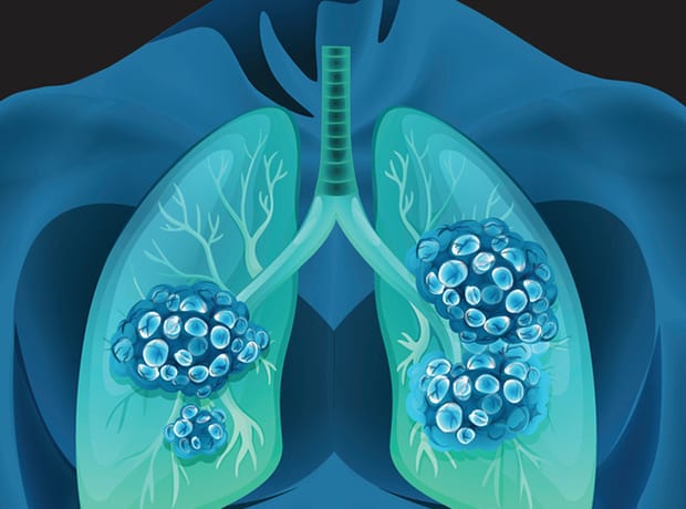 johnson-&-johnson-подайте-заявку-на-подкожную-дозировку-rybrevant-—-pharmatimes